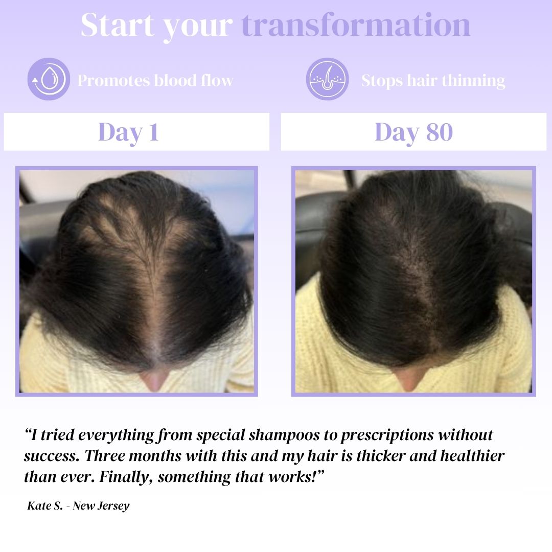 Hair Growth Shampoo