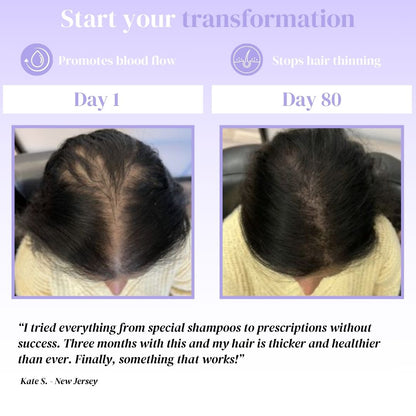 Hair Growth Shampoo