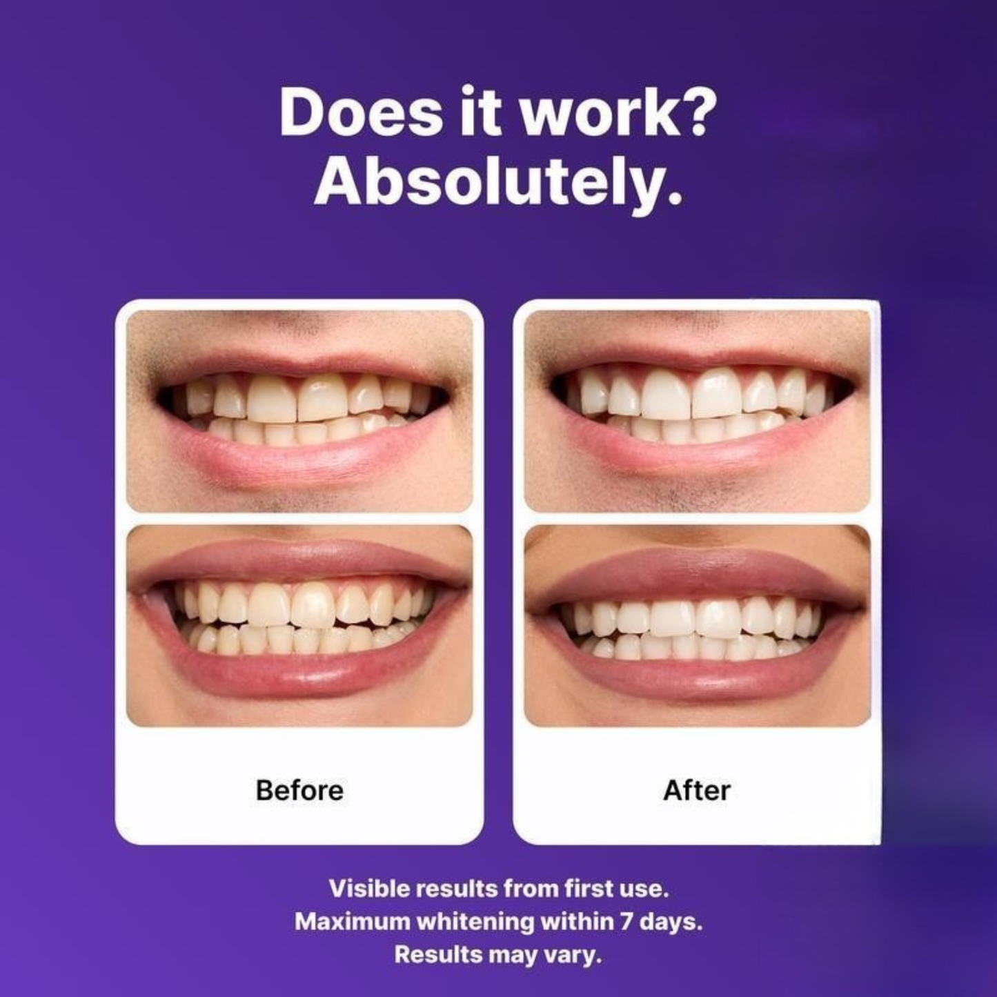 Whitening Strips